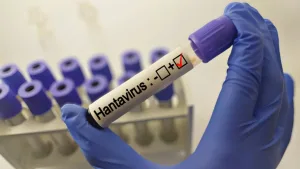 Hantavirusi, OBSH paralajmëron: Javët e ardhshme do të ketë “shpërthim” rastesh